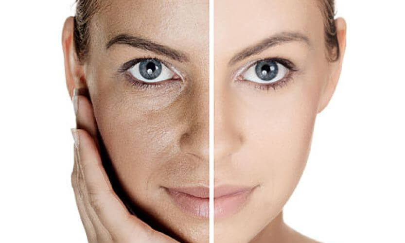 Platelet-rich Plasma for Skin Rejuvenation: 5 Interesting Facts You Need to Know